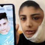Tümör Şişkinlikle Kendini Gösterdi